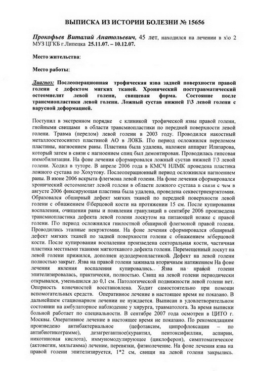 Лопасть для ласт своими руками Лопасть для ласт своими руками