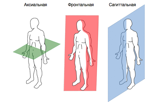 Кифоз у детей дошкольного возраста