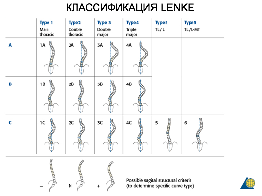 Корсет для осанки при 2 степени