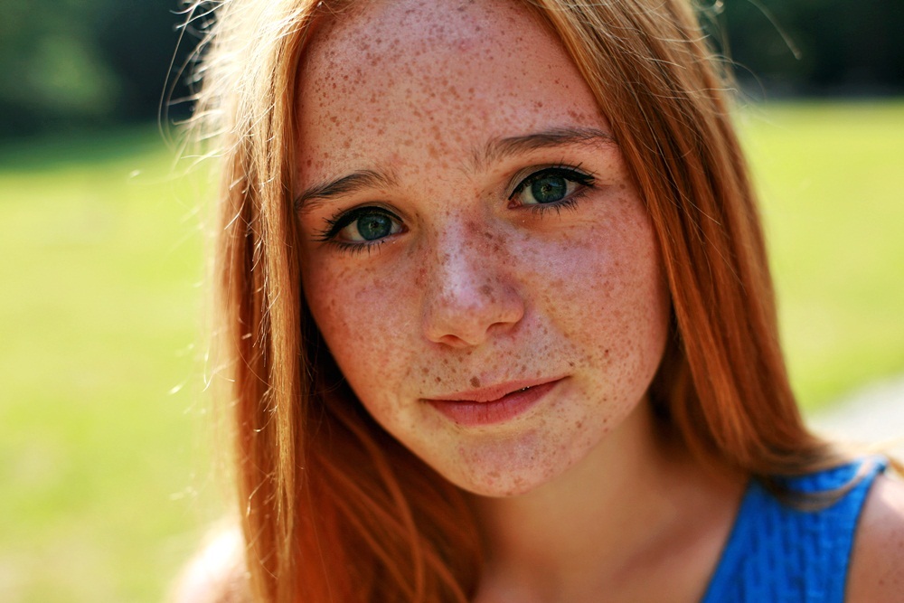 Freckles solo photo
