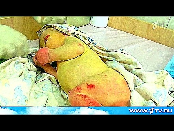 Роды под челябинском Роды под челябинском
