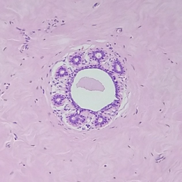 Atypia