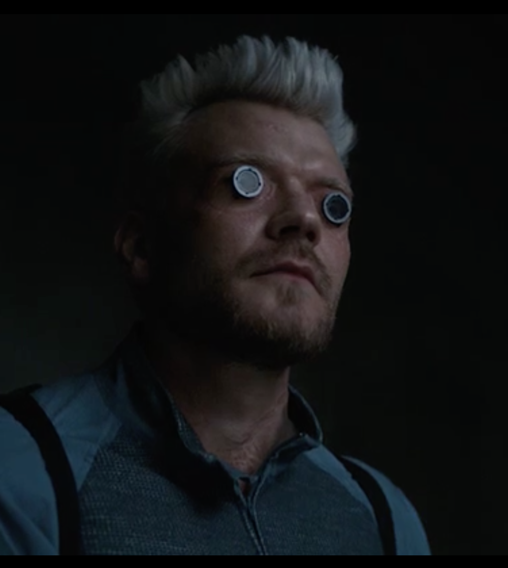 ВИДЕО: Слепой мужчина, которому поставили бионический глаз, показывает ...