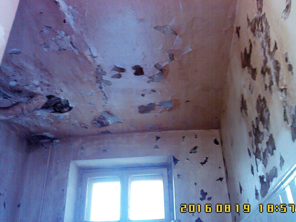 Про туберкулез | Пикабу