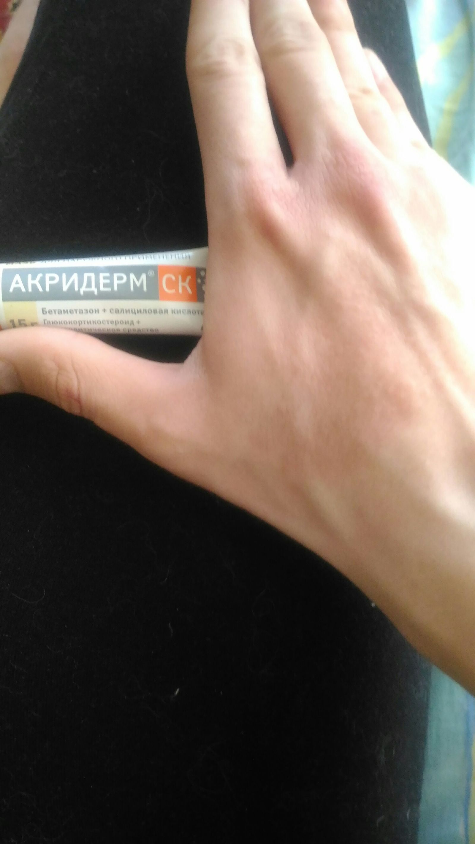Серьезные и безобидные факторы появления пятен на ногах и между пальцами Серьезные и безобидные факторы появления пятен на ногах и между пальцами