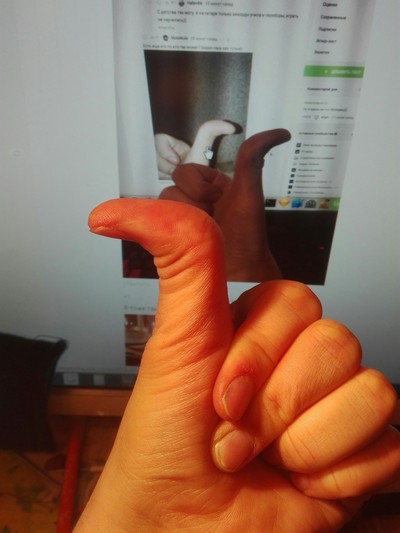 Иллюстрация к комментарию