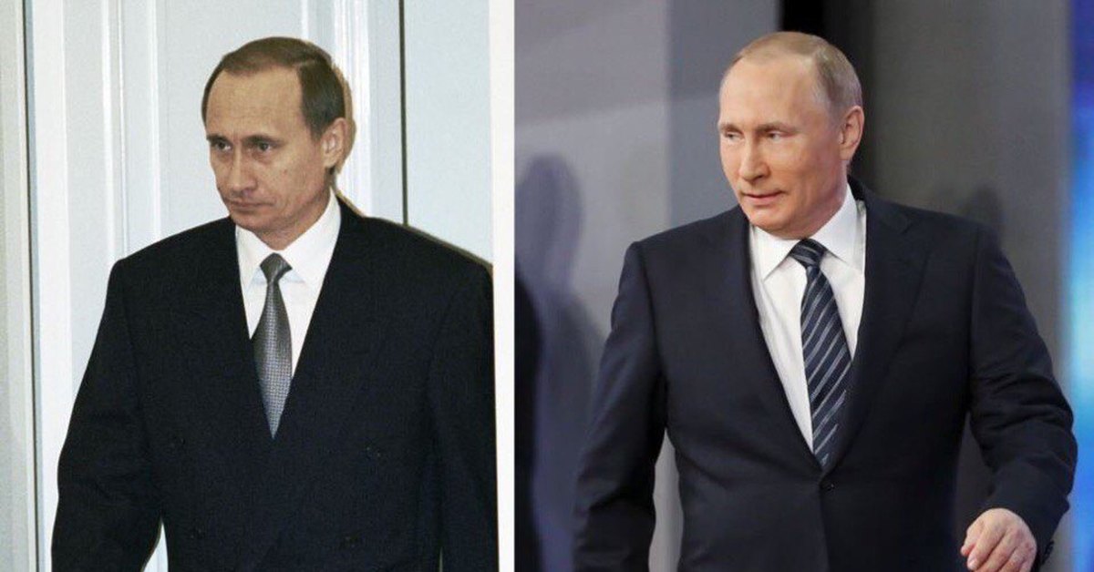 Путин в молодости фото до операции и после пластики фото