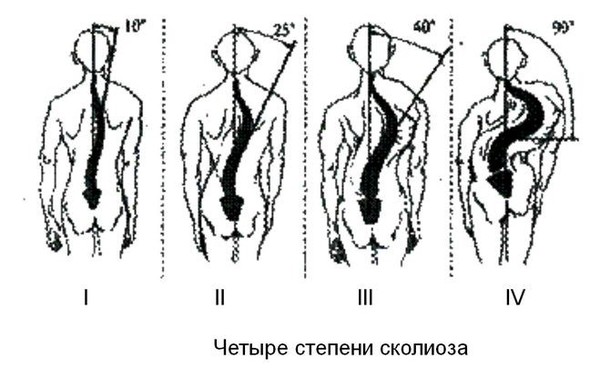 Будни ЛФКашника. - Моё, ЛФК, Реабилитация, Здоровье, Длиннопост, Дети, Лечение, Работа