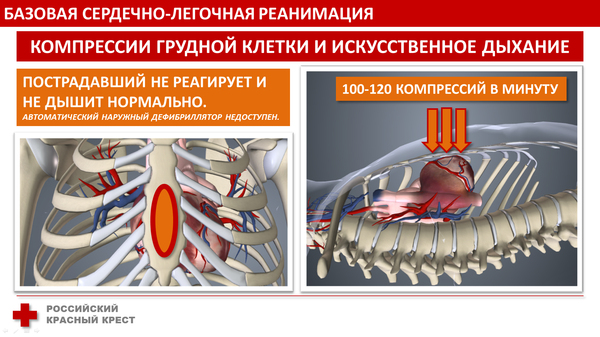 Красный крест реанимация