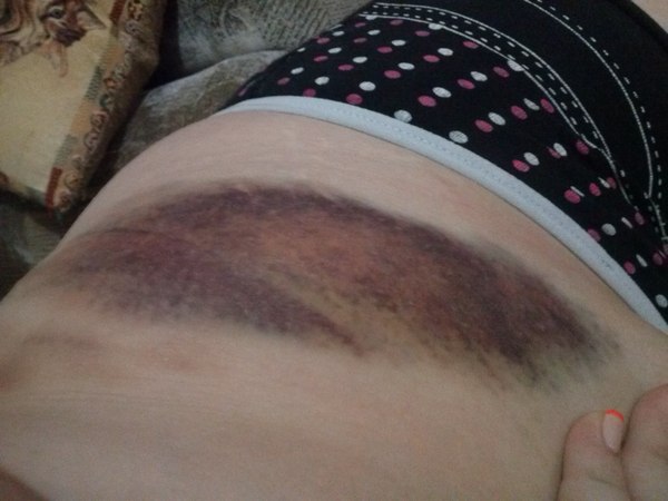 Опасно нынче худеть...