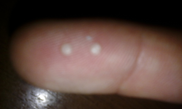 ����� ������������� ���������� ���������