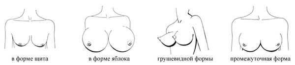 What shape is your chest? (only for girls) - NSFW, Breast, Girls, Forms, Humor