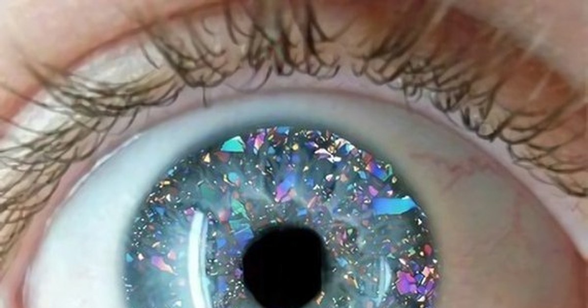 Прозрачное тело в глазу. Мушки стекловидного тела. Деструкция стекловидного тела глаза. Алмазные глаза. Глаза бриллианты.