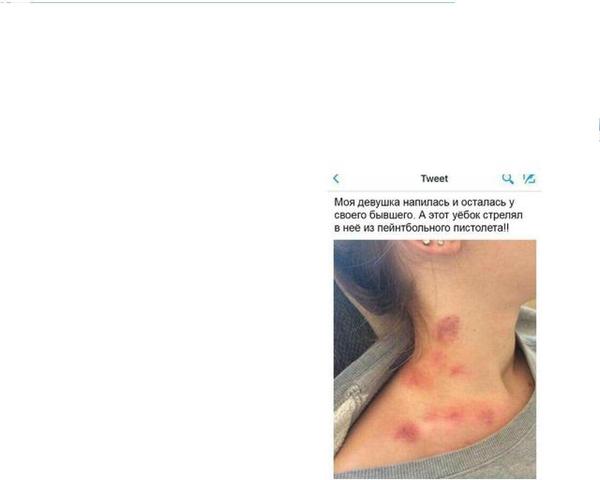 � - �������