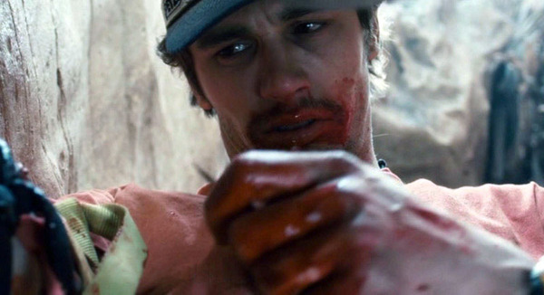 Кемеровчанин может остаться без руки из-за собственной кровати