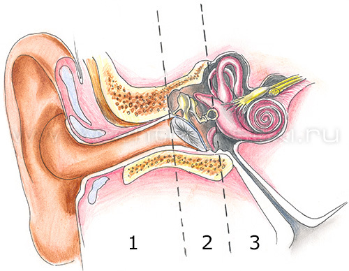 Части уха наружное среднее внутреннее. Отосклероз симптомы. Ухо человека строение. Наружный отдел уха. Три части уха.