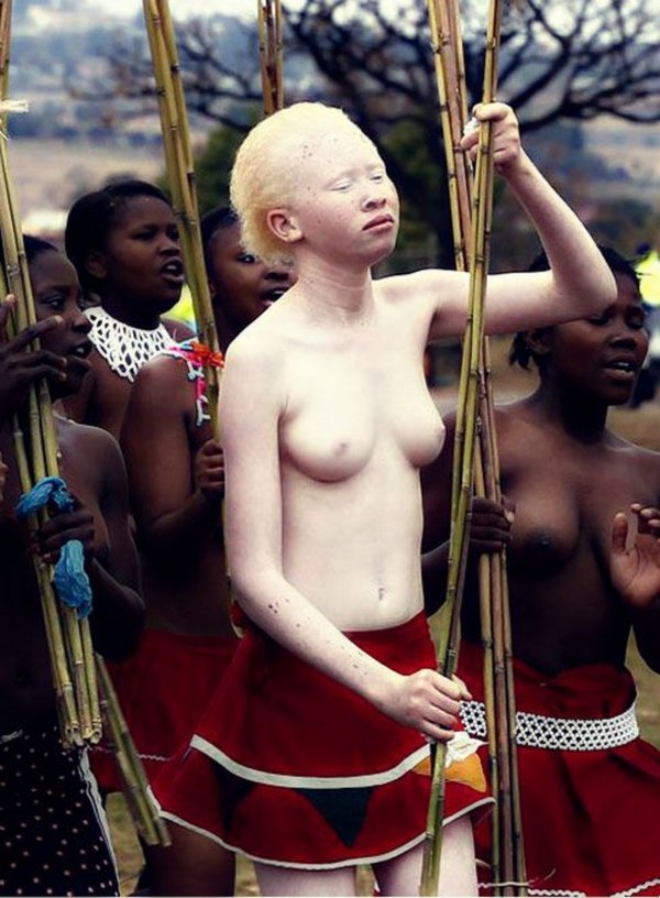 Albino black girl dancing folk dance - NSFW, Black people, African American, Albino, Africa, Reddit, Blacks