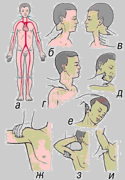 First Aid or how to wait for an Ambulance-16 - Harness, First aid, Bleeding, Longpost