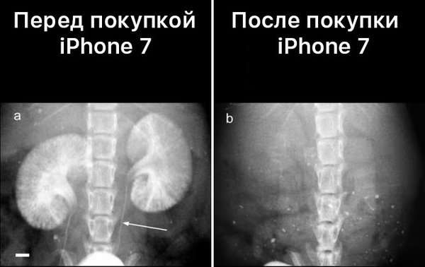 Diagnosis: unfortunately you have Applemania - iPhone, iPhone 7, Show off, Where's the money