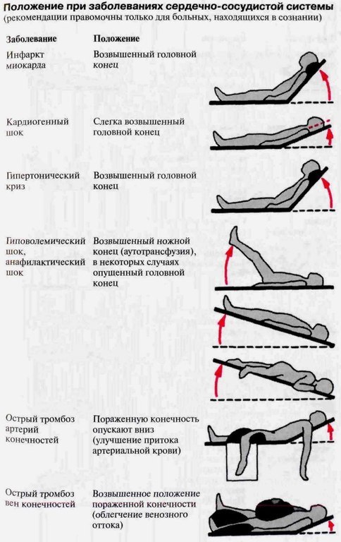 Различные положения человека - Медицина, Поза, Травма, Слз, Нарушения дыхания, Длиннопост