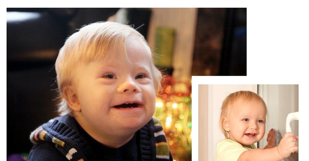 Может ли ребенок быть похож. Внешность детей с синдромом Дауна. Дети похожие на даунов. Дети с синдромом Дауна фото.