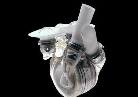 Autonomous artificial heart. - The science, Future, Useful, Why?, Inventions, Technologies