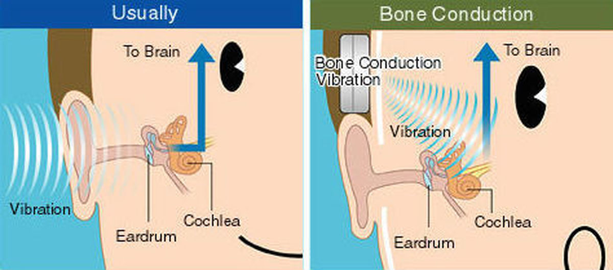 Костная проводимость. Костная проводимость звука. Костное проведение звука. Воздушная и костная проводимость звука. Воздушная и костная проводимость слуха.