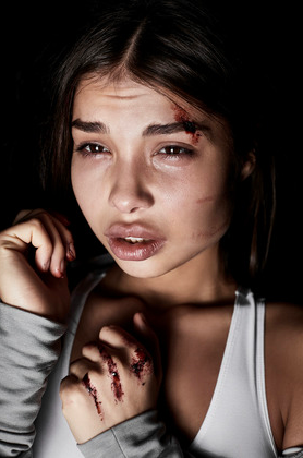 Victims of domestic violence - My, Female, Russia, Photo, Exhibition, Longpost, Women