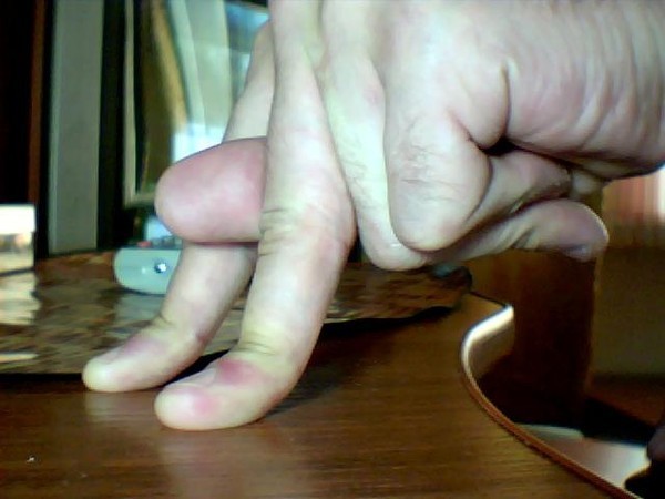 �������� - ����������� ������� ������� �� ��� !!!