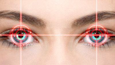 Laser eye surgery - My, Femto LASIK, Eye surgery, , Video, Longpost, LASIK, Laser correction