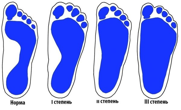 ���� ������������ � ��������� ����� � ����������� �� ���������