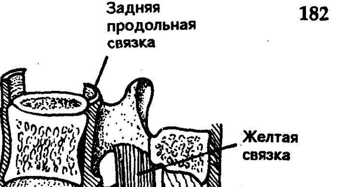 Продольная связка. Задняя продольная связка. Передняя и задняя продольные связки. Уплотнение задней продольной связки. Задняя продольная связка позвоночника.