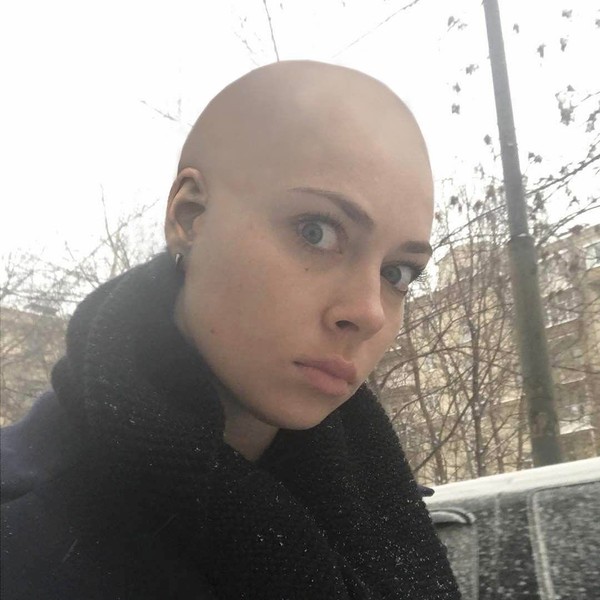 Answered - bald, Nastasya Samburskaya, University