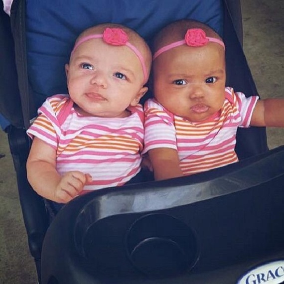 Colored twins born in US - USA, Twins, news, Unusual, Text, Longpost