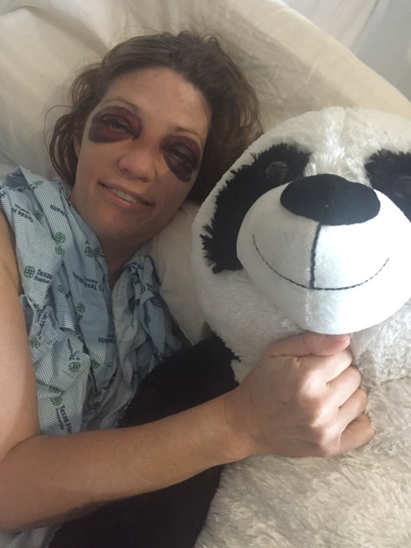 Her face was smashed and someone gave such a gift - Female, Fingal, Panda, The photo, Women, Bruise