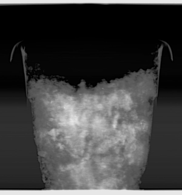 - , X-ray,  , 