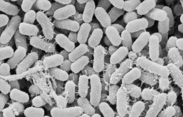 serratia odorifera что это. Смотреть фото serratia odorifera что это. Смотреть картинку serratia odorifera что это. Картинка про serratia odorifera что это. Фото serratia odorifera что это