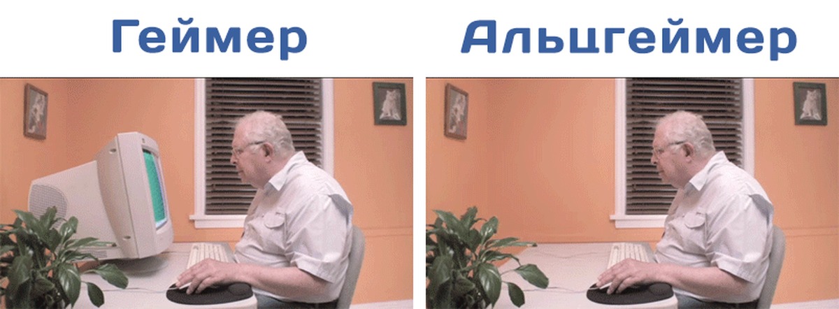 Альцгеймер шутки