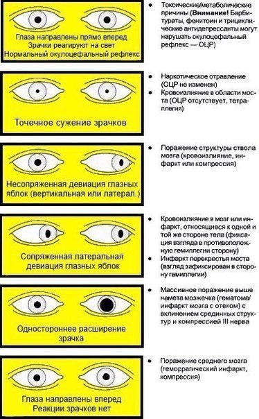 Роговичный рефлекс: что это за механизм и почему он так важен?