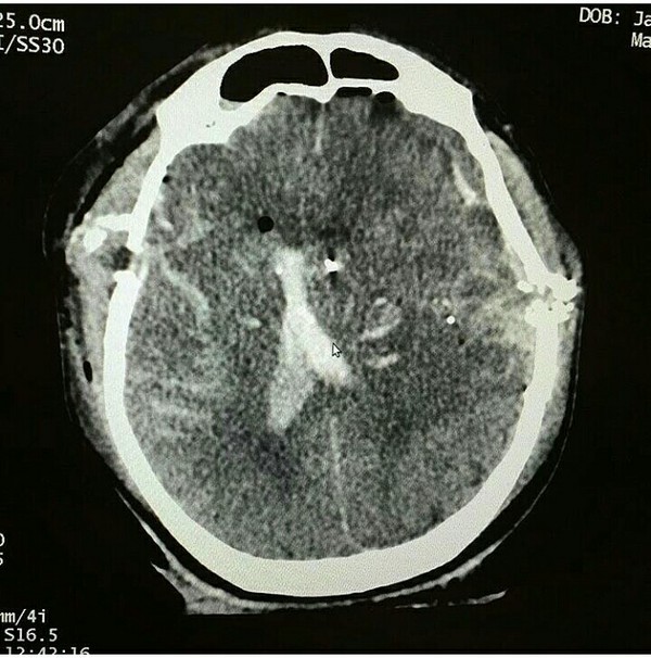 �������� �������.