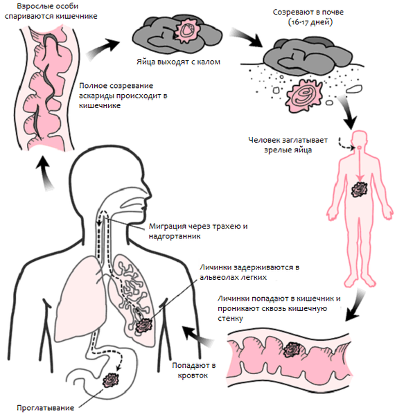 Ascariasis in children - The medicine, Ascariasis, Disease, Roundworm, Images, Text, Longpost