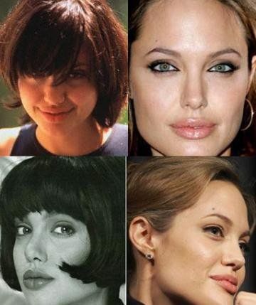 Celebrities who have had plastic surgery - Stars, Celebrities, Hollywood, Plastic, Interesting, Article, It Was-It Was, Longpost
