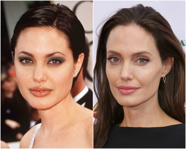 Lumps of Bish: to remove or not - beauty, Plastic surgery, Hollywood, , Adele, Angelina Jolie, Longpost