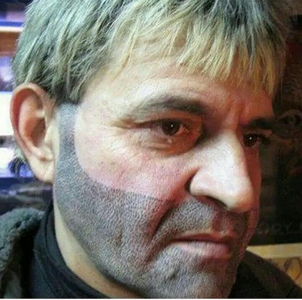 Èñòîðèÿ ìîåé áîðüáû ñ îáëûñåíèåì, èëè ÷òî òàêîå òðèõîïèãìåíòàöèÿ Îáëûñåíèå, Òàòó, Òðèõîïèãìåíòàöèÿ, Áîðüáà, Èñòîðèÿ, Âèäåî, Äëèííîïîñò