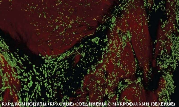 ������ ���������� �������� � ���������� ��������� �����