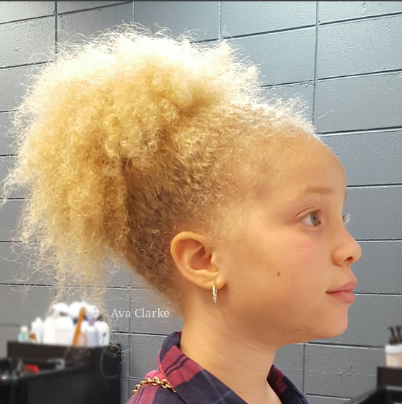 Ava Clarke is an albino African American. - , Children, Albino, Blonde, Black people, Models, Unusual, Interesting, Longpost