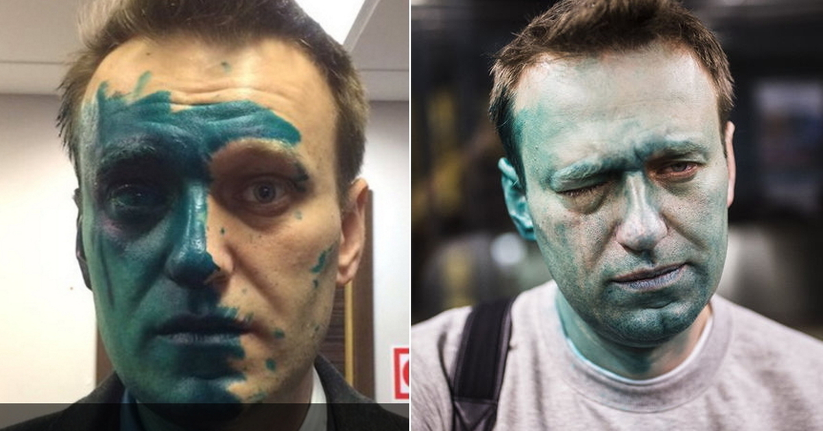 Навальный мразь. Навального облили зелёнкой.