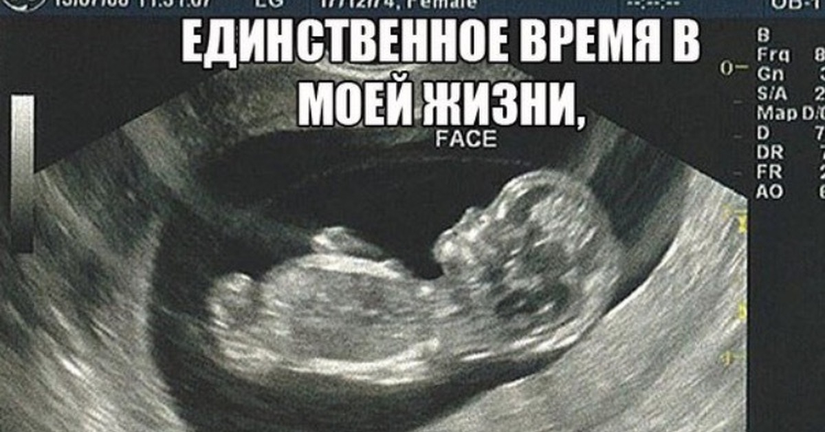 11 неделя 2024г. Эмбрион на 9 неделе беременности УЗИ. Зародыш 11 недель УЗИ. УЗИ плода на 9-10 неделе беременности.