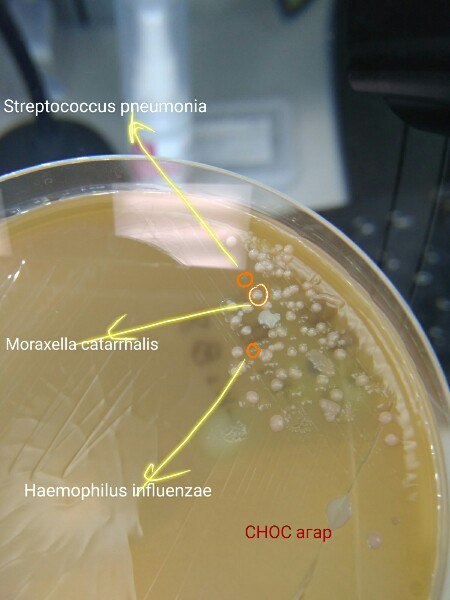 And again plant environments - Longpost, The medicine, Microbiology, Environment, Bacteria, The photo, Text