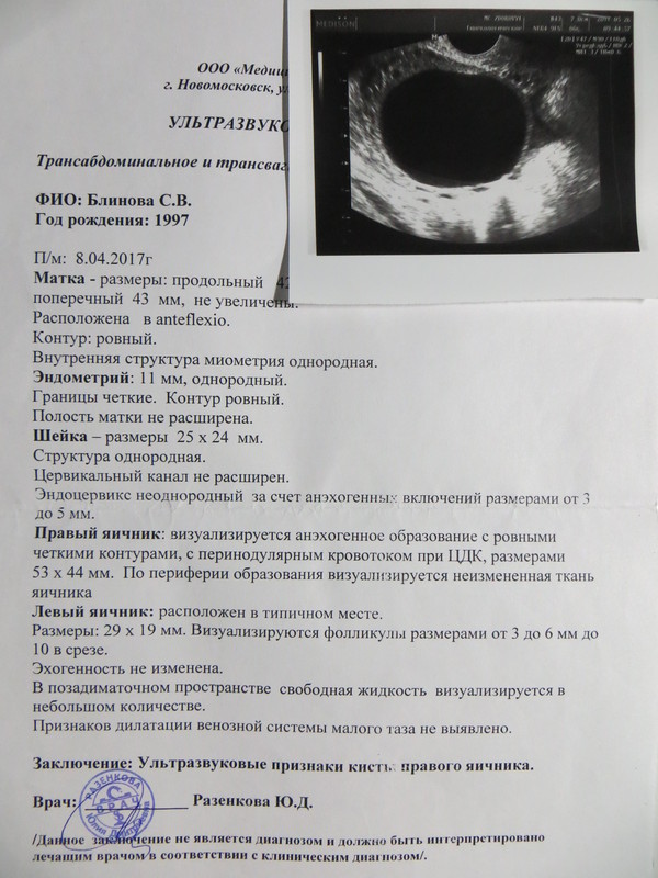 REALLY NEED HELP! URGENTLY! Diagnosis: cyst - My, Operation, Urgently, Help, Money, , , Longpost